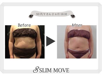 カウピリ(kaupili)/最新痩身マシン【スリムムーヴ】