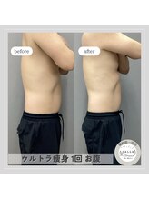 カラー(CALLA)/メンズもエステに通う時代！