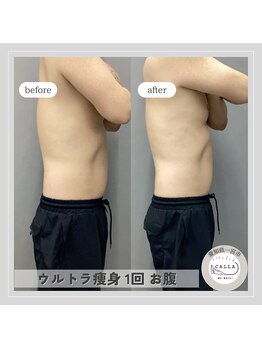 カラー(CALLA)/メンズもエステに通う時代！