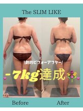 スリムライク 鳥取店(The SLIM LIKE)/痩身ビフォーアフター