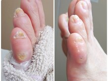 リゼラアンドコー 浦安店/ドイツ式フットケア専門店