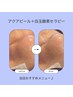 人気No.1☆毛穴洗浄アクアピール×白玉酸素セラピー+LED管理