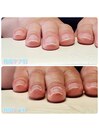 最強のネイルケア お試し体験