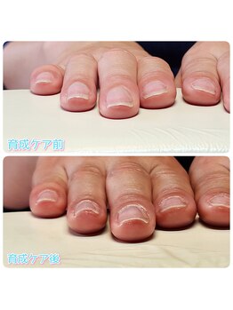 最強のネイルケア お試し体験