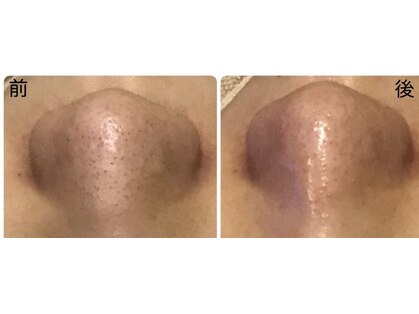 漢方エステ BSYの写真