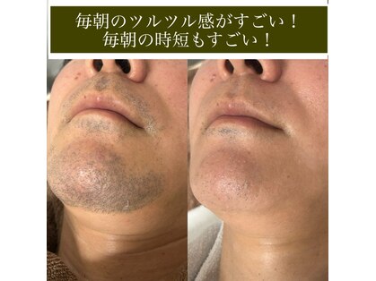 フュチュール(futur)の写真
