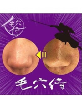 ソワン(Soin)/◇毛穴洗浄♪