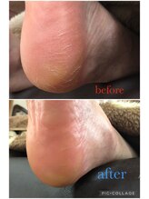 足楽ほんぽ/角質ケア