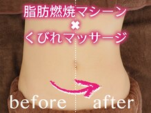 ファニービー 吹田店