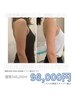 脂肪冷却×高周波×次世代EMS5回コース×酵素付き135分通常348,000円→98,000