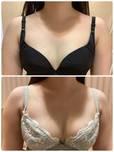 レイビス 仙台店(RAYVIS)/バストケア☆2