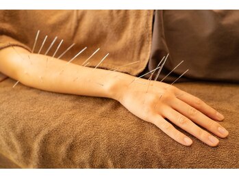 はりひろし鍼灸院/