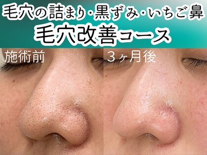 アルカンシエル(arcenciel)の写真