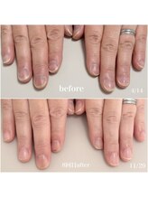 ニカ(Nica)/【自爪育成】