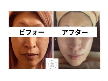 アロマリラクゼーションローザ(Roza)の雰囲気（メニュー名→コンシーラー卒業　背中から整える）