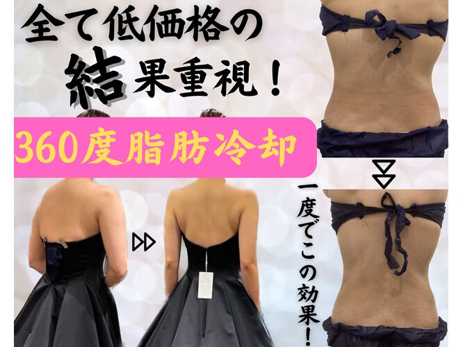 ディオーネ(Dione)｜ホットペッパービューティー