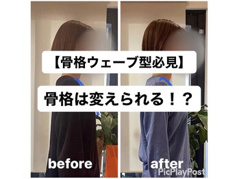 カワル整体 上通り院/骨格ウェーブ型に多い症状