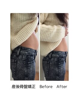 こころ整骨院 こころ鍼灸院/産後骨盤矯正 Before After