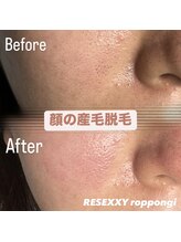 リゼクシー INTERNATIONAL麻布十番 六本木(RESEXXY)/