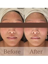 凪眠/小顔リンパフェイシャルの効果23