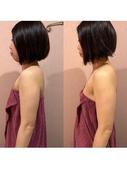 アンベリール(Embellir)/バストケア「ボンボンバスト」