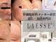 ラエッセ 恵比寿(LAESSE)の写真