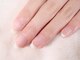 ネイルサロン ブランシュール(Nail Salon Blancheur)の写真/《深爪専用》爪悩みはケアで変えられる!美しい素の爪を目指す育爪ケア+クリアジェル※写真改善半年後