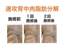 鍼灸サロンオランジュ 高槻富田院/