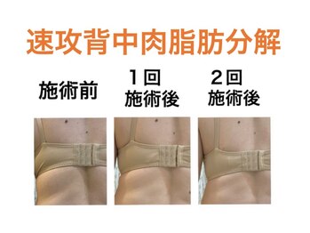 鍼灸サロンオランジュ 高槻富田院/