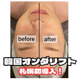 ディア(Deer)