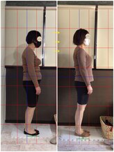 リラクゼーションアンドビューティー コウ(Kou)/【美容整骨/お客様の変化】