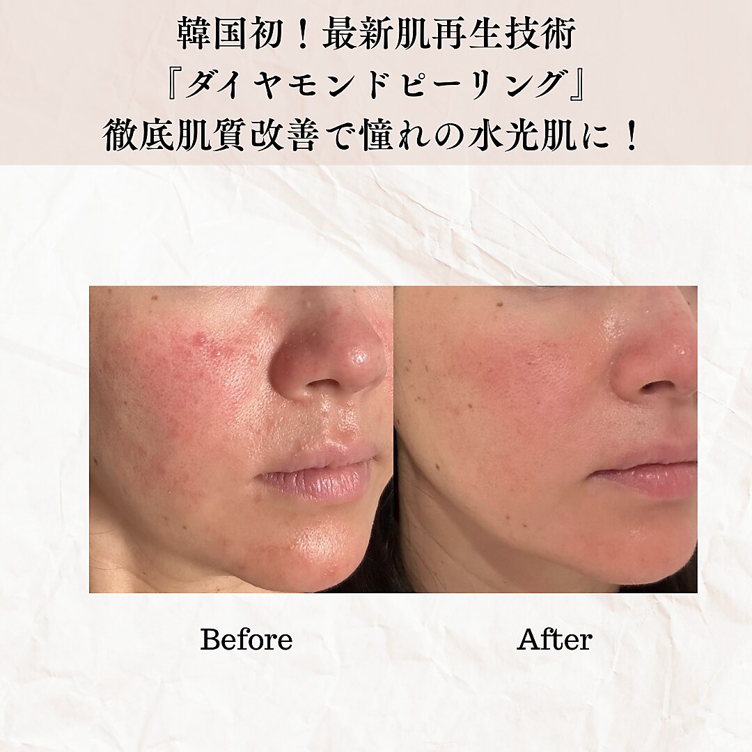 3ページ目｜茅ヶ崎市でフェイシャルエステが人気のエステサロン