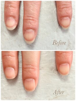 ソワン(soin)/Before→After