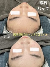 サリエ(S'allier)/磁石パック!! 透明感と毛穴ケア
