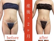 ウィズルーチェ 神栖店(with luce)/産後痩身効果★痩せない身体に