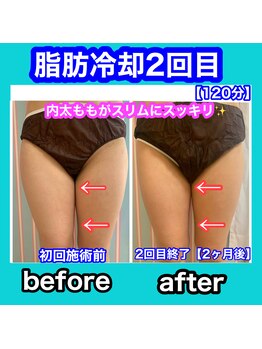 ビューティ ウィッチ(Beauty Witch)/