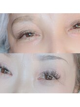 オメメドウ(OMEMEDO)/いくつになっても若々しく！