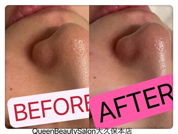 クイーン ビューティーサロン 大久保本店(Queen Beauty Salon)/お客様のBefore→After