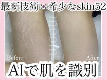 ムーム なんば店(moom)の雰囲気（韓国最新機器☆AIでお肌の色を識別し、素肌へ馴染ませる新技術）