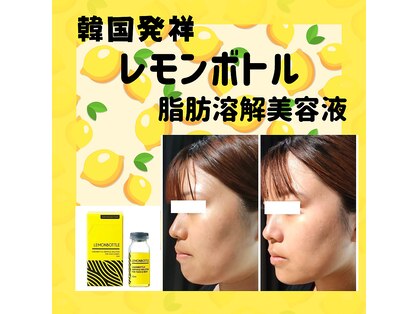 ルアナ(Luana)の写真