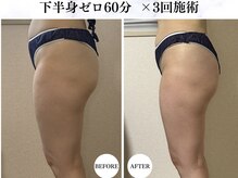 シーフェイス 横浜店(SEE FACE)/温活痩身下半身ゼロ 60分コース