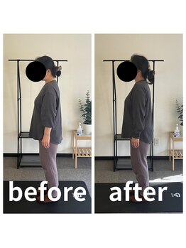 熊本カワル整体 JR上熊本駅院/姿勢改善