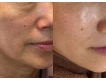 なかま鍼灸整骨院の雰囲気(【40代からの本気の肌質改善】たるみ、シワ、しみを改善します。)