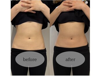 マホロバ セカンド(mahoroba 2nd)/くびれスッキリ腸マッサージ