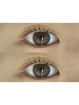 まつげのお悩み解決サロン