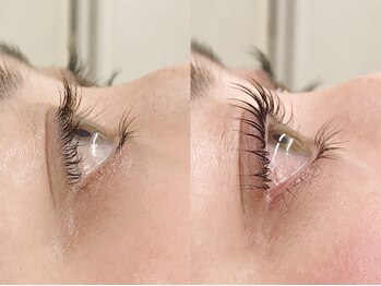 カヌマ(kanuma)/ビフォー&アフター