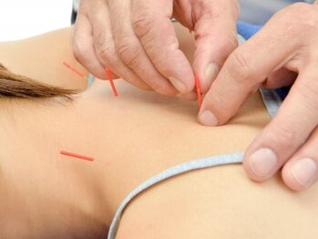 やけの鍼灸整骨院の写真/長年の痛みから解放されたい方★国家資格者による「西洋医学×東洋医学」のハイブリッド施術で効果を体験!