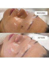 ミーティス/美白もツヤも同時にケア♪