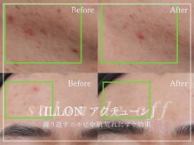 サロンドオフ 御堂筋店(salon de off)