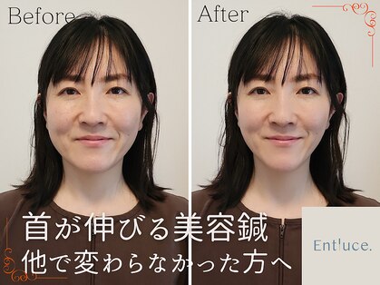 アントルーチェ 代々木上原(Entluce.)の写真